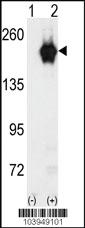 Anti-GAK Rabbit Polyclonal Antibody