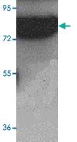 Anti-ESRP2 Rabbit Polyclonal Antibody