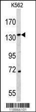 Anti-CD163 Rabbit Polyclonal Antibody (AP (Alkaline Phosphatase))