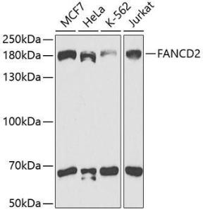 Western blot analysis of extracts of various cell lines, using Anti-FANCD2 Antibody (A307987) at 1:1,000 dilution