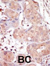 Anti-MAK Rabbit Polyclonal Antibody (HRP (Horseradish Peroxidase))