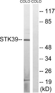 Western blot analysis of lysates from COLO cells using Anti-STK39 Antibody. The right hand lane represents a negative control, where the antibody is blocked by the immunising peptide.