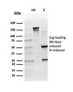 SDS-PAGE analysis of Anti-RXRB Antibody [PCRP-RXRB-2B6] under non-reduced and reduced conditions; showing intact IgG and intact heavy and light chains, respectively. SDS-PAGE analysis confirms the integrity and purity of the antibody