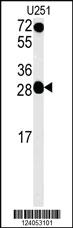 Anti-HOXC6 Rabbit Polyclonal Antibody