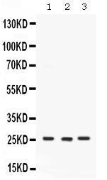 Anti-CACYBP Antibody