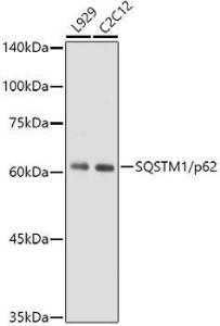 Western blot analysis of extracts of various cell lines, using Anti-SQSTM1/p62 Antibody [ARC0180] (A306736) at 1:1000 dilution. The secondary Antibody was Goat Anti-Rabbit IgG H&L Antibody (HRP) at 1:10000 dilution. Lysates/proteins were present at 25 µg per lane