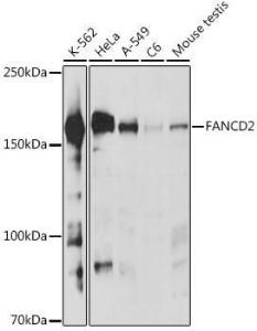 Western blot analysis of extracts of various cell lines, using Anti-FANCD2 Antibody (A307988) at 1:1000 dilution