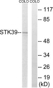 Western blot analysis of lysates from COLO205 cells using Anti-STK39 Antibody. The right hand lane represents a negative control, where the antibody is blocked by the immunising peptide.