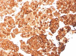 Immunohistochemical analysis of formalin-fixed, paraffin-embedded human pancreas using Anti-Cytokeratin 6A Antibody [rKRT6A/2100]