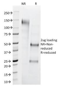 SDS-PAGE analysis of Anti-Cytokeratin 1 Antibody [LHK1] under non-reduced and reduced conditions; showing intact IgG and intact heavy and light chains, respectively. SDS-PAGE analysis confirms the integrity and purity of the antibody