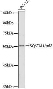 Western blot analysis of extracts of PC-12 cells, using Anti-SQSTM1/p62 Antibody [ARC0180] (A306736) at 1:1000 dilution. The secondary Antibody was Goat Anti-Rabbit IgG H&L Antibody (HRP) at 1:10000 dilution. Lysates/proteins were present at 25 µg per lane