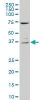 Anti-CD68 Mouse Polyclonal Antibody