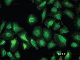 Anti-PGM1 Mouse Monoclonal Antibody [clone: 3B8-H4]