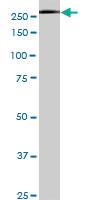 Anti-USP9X Mouse Monoclonal Antibody [clone: 5D7]