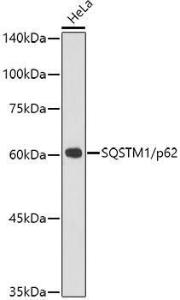 Western blot analysis of extracts of HeLa cells, using Anti-SQSTM1/p62 Antibody [ARC0180] (A306736) at 1:1000 dilution. The secondary Antibody was Goat Anti-Rabbit IgG H&L Antibody (HRP) at 1:10000 dilution. Lysates/proteins were present at 25 µg per lane