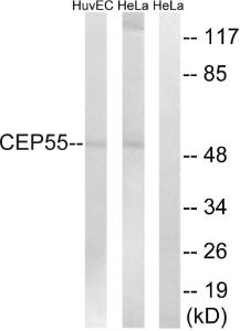 Western blot analysis of lysates from HeLa and HUVEC cells using Anti-CEP55 Antibody. The right hand lane represents a negative control, where the Antibody is blocked by the immunising peptide