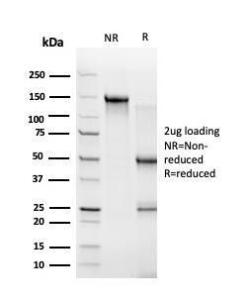 Anti-ZBTB46 antibody