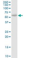 Anti-STS Rabbit Polyclonal Antibody