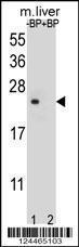 Anti-T4S4 Rabbit Polyclonal Antibody (Biotin)