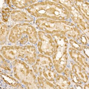 Anti-RPLP2 Rabbit Polyclonal Antibody