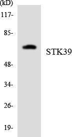 Western blot analysis of the lysates from HeLa cells using Anti-STK39 Antibody