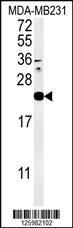 Anti-HCAR2 Rabbit Polyclonal Antibody