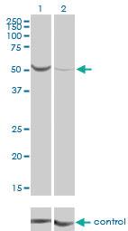 Anti-PGM1 Mouse Monoclonal Antibody [clone: 3B8-H4]