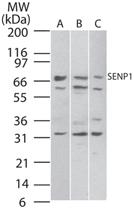 Anti-SENP1 Rabbit Polyclonal Antibody