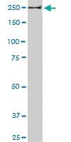 Anti-USP9X Mouse Monoclonal Antibody [clone: 5D7]