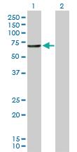 Anti-CNDP1 Rabbit Polyclonal Antibody