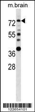 Anti-ESR1 Rabbit Polyclonal Antibody (Biotin)