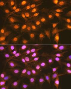 Immunofluorescence analysis of C6 cells using Anti-FANCD2 Antibody (A307988) at a dilution of 1:100 (40x lens). DAPI was used to stain the cell nuclei (blue)