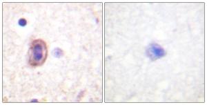 Immunohistochemical analysis of paraffin-embedded human brain tissue using Anti-SEK1 Antibody. The right hand panel represents a negative control, where the antibody was pre-incubated with the immunising peptide.