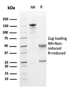 SDS-PAGE analysis of Anti-CD5 Antibody [CD5/2419] under non-reduced and reduced conditions; showing intact IgG and intact heavy and light chains, respectively. SDS-PAGE analysis confirms the integrity and purity of the antibody