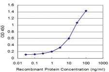 Anti-USP9X Mouse Monoclonal Antibody [clone: 3E12]