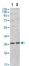 Anti-PPP1CA Mouse Monoclonal Antibody [clone: 6D1]