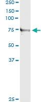 Anti-TNXB Antibody Pair