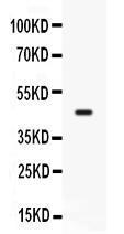 Anti-CD33 Antibody