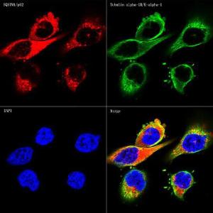 Confocal imaging of HeLa cells using Anti-SQSTM1/p62 Antibody [ARC0180] (A306736), at a dilution of 1:200, (red). The cells were counterstained with Anti-alpha Tubulin Antibody, at a dilution of 1:100, (green). DAPI was used for nuclear staining (Blue). Objective: 60x