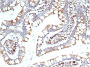 Immunohistochemical analysis of formalin-fixed, paraffin-embedded human small intestine tissue using Anti-TREM2 Antibody [TREM2/7210]