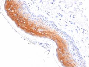 Immunohistochemical analysis of formalin-fixed, paraffin-embedded human skin using Anti-Cytokeratin 1 Antibody [KRT1/1840]