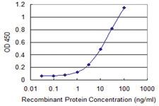 Anti-PGM1 Mouse Monoclonal Antibody [clone: 3B8-H4]