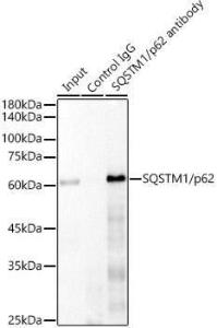 Immunoprecipitation analysis of 300 µg extracts of 293T cells using 3 µg of Anti-SQSTM1/p62 Antibody [ARC0180] (A306736). This Western blot was performed on the immunoprecipitate using Anti-SQSTM1/p62 Antibody [ARC0180] (A306736) at a dilution of 1:1000