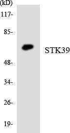 Anti-STK39 antibody