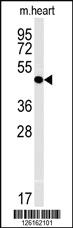 Anti-IL5RA Rabbit Polyclonal Antibody