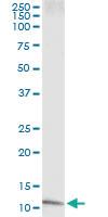 Anti-CXCL8 Mouse Monoclonal Antibody [clone: 4G11]