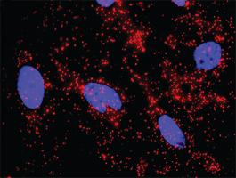 Anti-RPS6KB1 Antibody Pair