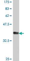 Anti-DTYMK Mouse Polyclonal Antibody