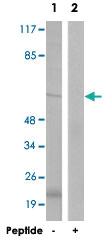 Anti-DAB1 Rabbit Polyclonal Antibody