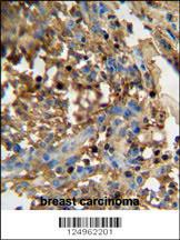 Anti-FAM20C Rabbit Polyclonal Antibody (HRP (Horseradish Peroxidase))